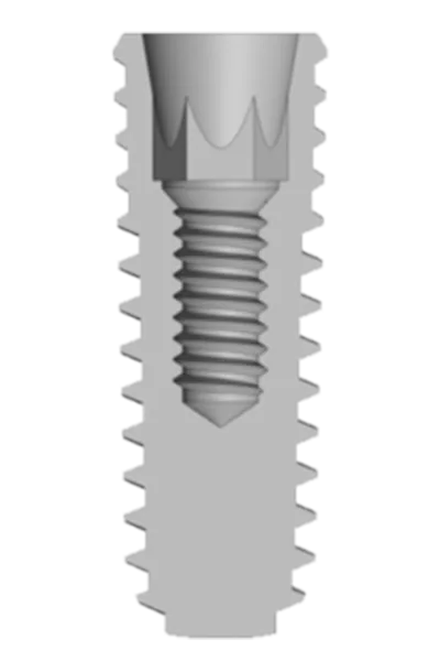 TS implant, inside view